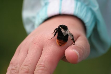 Ouch, That Stings, Hurts, Burns!! 10 bee on small childs hand