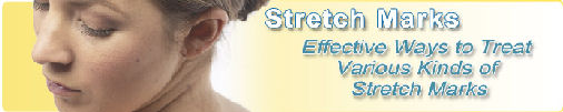 Recovering From Childbirth 7 stretch header sm